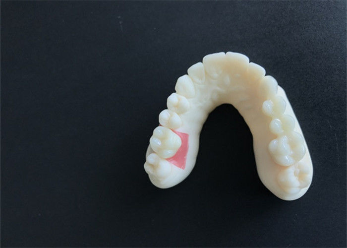 3D Digital Model CAD CAM Design Dentures Dental Laboratory