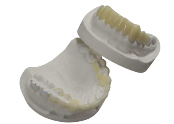 High Durability CAD CAM 3D Printing Temporary Crowns Durable Resin