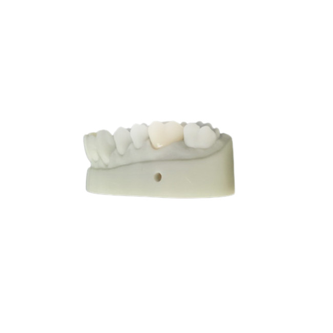 OEM 3D Printed Dental Models CAD CAM Design For Denture Laboratory