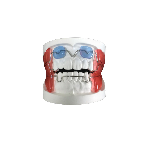 Fixed Appliance Dental Functional Appliance Good Fixation Adequate ...